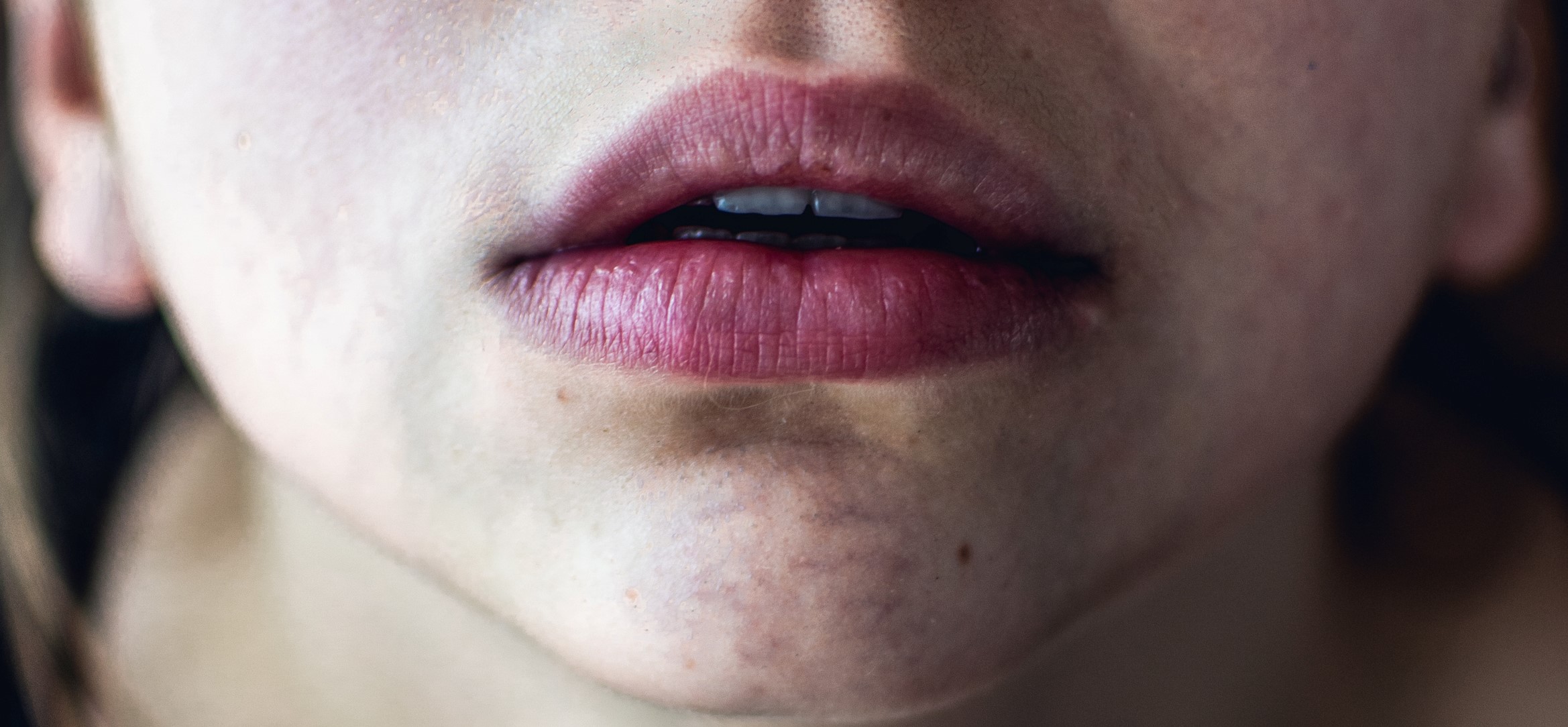 Dry lips or cracked lips