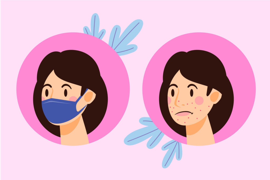face mask skin problems